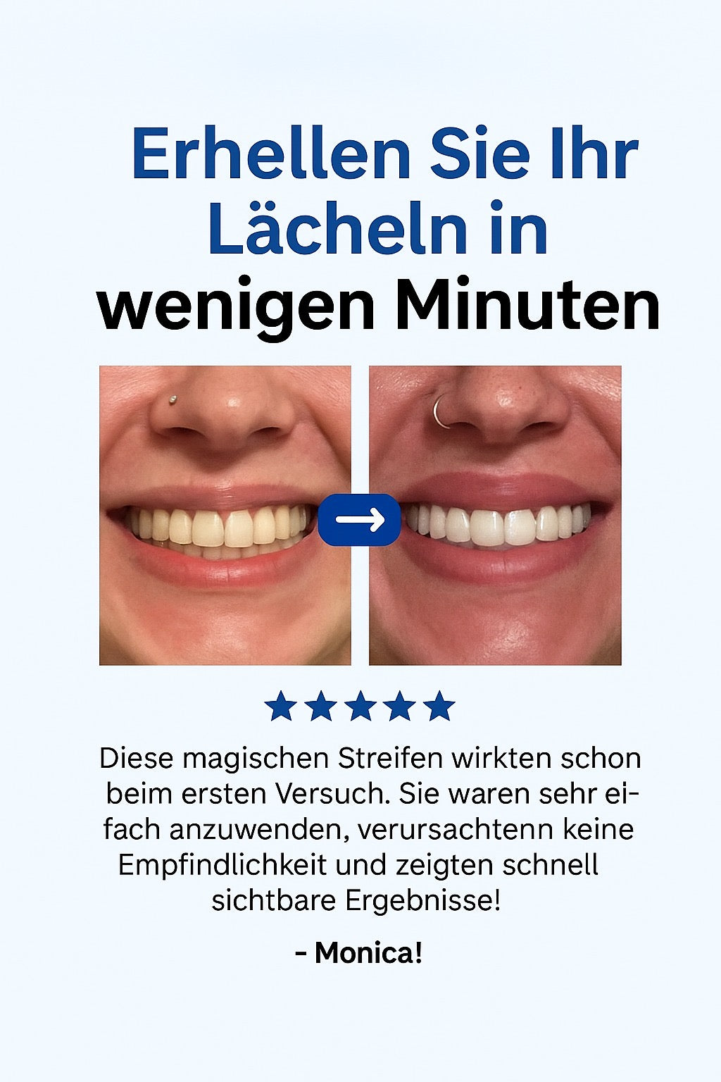 DentXpert® LED-Zahnaufhellungsset