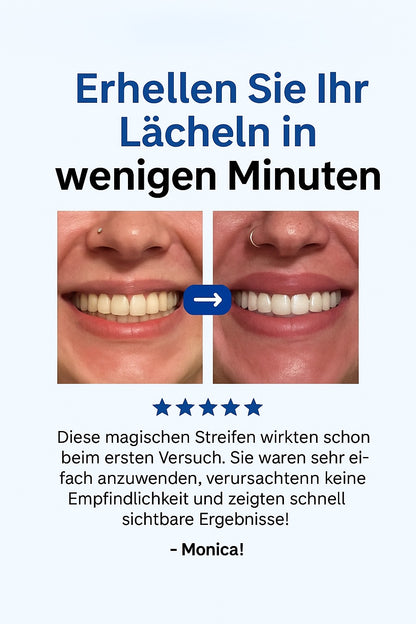 DentXpert® LED-Zahnaufhellungsset